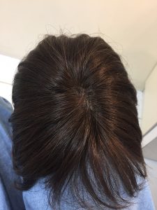 抗がん剤治療後の自毛をカットカラー縮毛矯正で地毛デビューできるヘアスタイルに