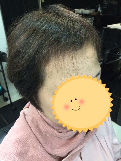 こんなに変わる 薄い前髪にシールエクステをつけて大変身 抗がん剤治療後のヘアケアブログ An 池袋本店