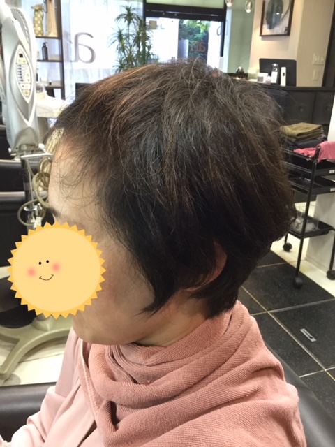 こんなに変わる 薄い前髪にシールエクステをつけて大変身 抗がん剤治療後のヘアケアブログ An 池袋本店