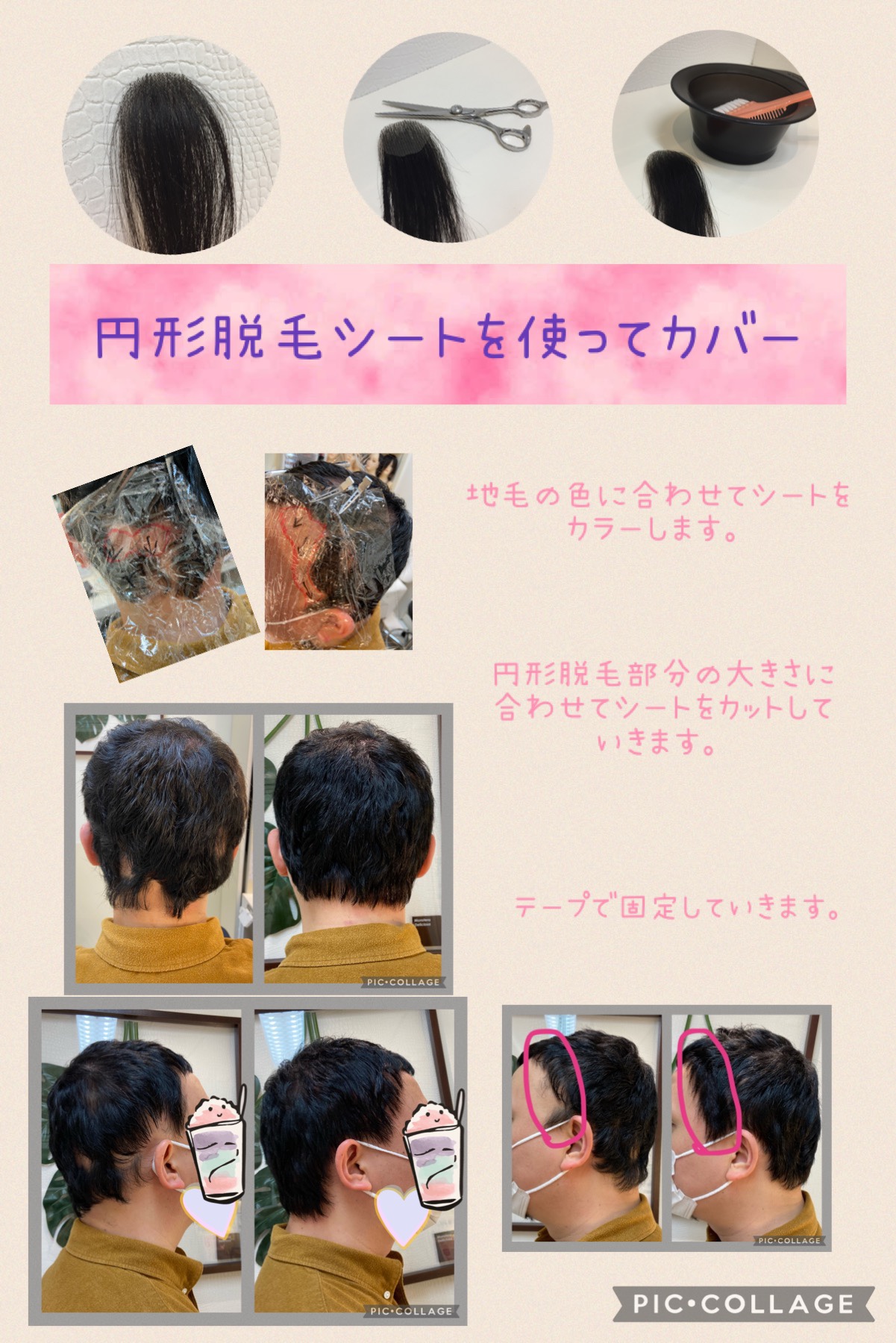 トップに円形脱毛 抗がん剤治療後のヘアケアブログ An 池袋本店