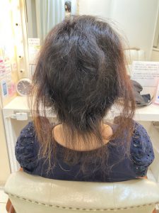 抗がん剤治療・頭皮冷却等で抜け残った髪のお手入れ、必見の内容です