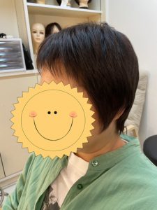 抗がん剤治療後のなかなか伸びない頭頂部をトップピースでカバー！