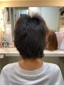 抗がん剤治療後のクセや短い前髪にストレートパーマやシールエクステで大変身！