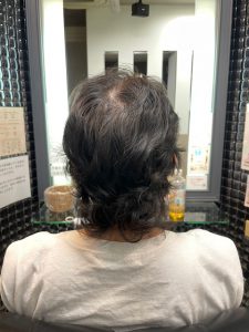 抗がん剤治療後に縮毛矯正、カットカラー、そしてトップピースで自毛デビュー