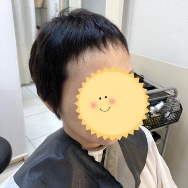 部分的に髪が伸びづらくなる