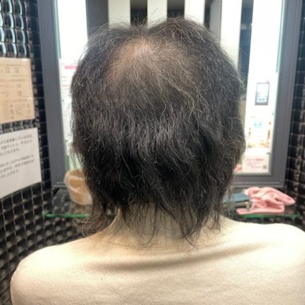 髪が細くなる、毛量が減る