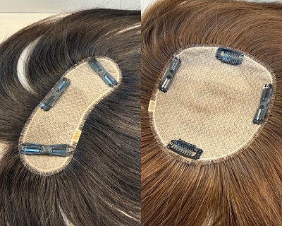 薄毛や再生毛に特化した美容師が担当