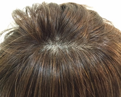 薄毛や再生毛に特化した美容師が担当